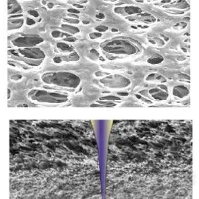 High Liquid Capacity PES Membrane for IV Infusion and Drip Chamber Filtration