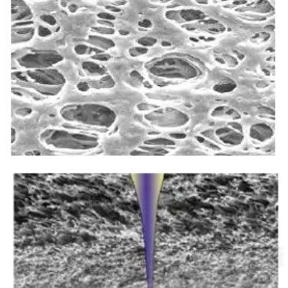 High Liquid Capacity PES Membrane for IV Infusion and Drip Chamber Filtration